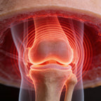 TROVAIN™ KINIE | Niemiecki Sposób na Ból Kolana